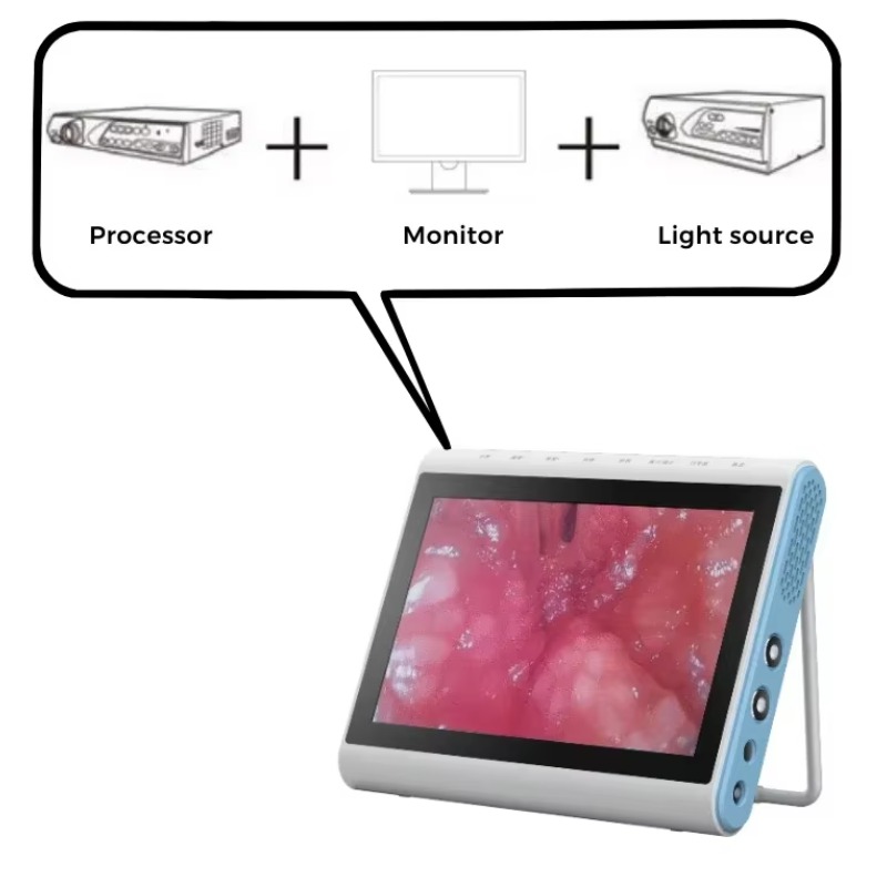 3‑In‑1 Medical Endoscopy Image - đánh giá và giá Medical Lab Images