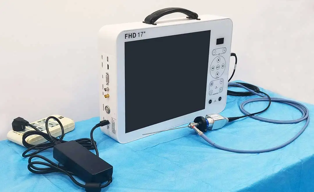 17 Inch HD Video Otoscope ENT  - đánh giá và giá Medical Lab Images
