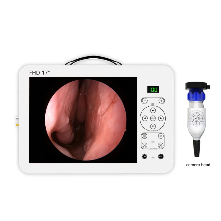 17 Inch HD Video Otoscope ENT  - đánh giá và giá Medical Lab Images