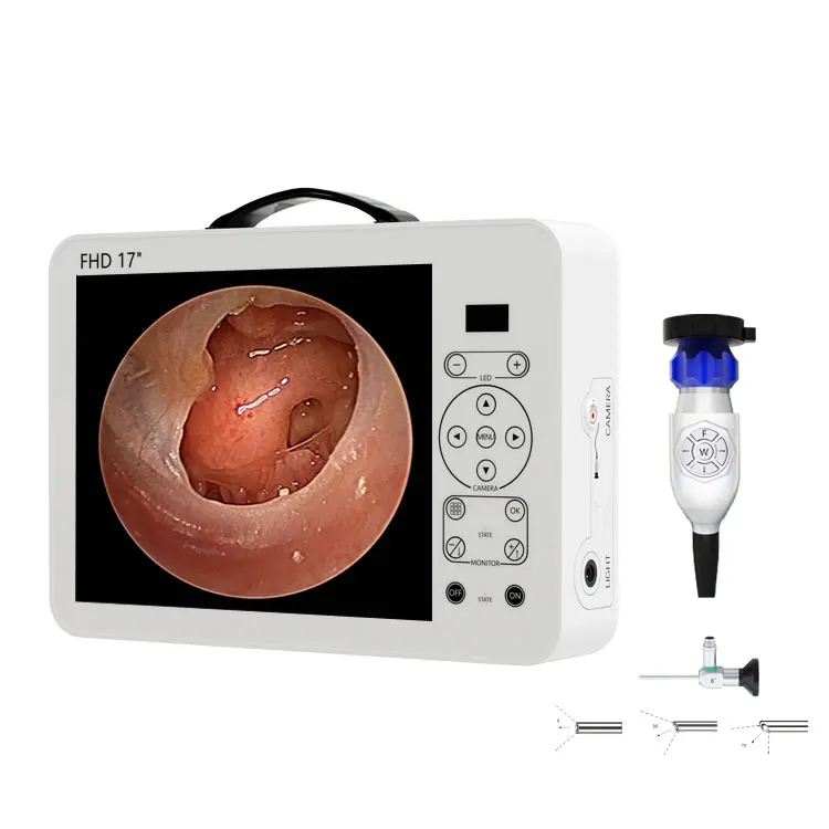 17 Inch HD Video Otoscope ENT  - đánh giá và giá Medical Lab Images