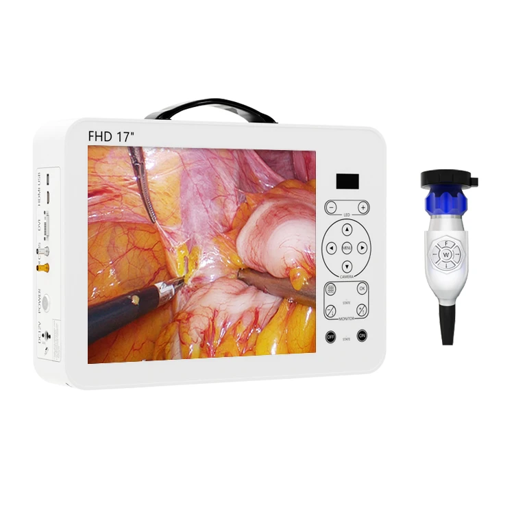 17 Inch HD Video Otoscope ENT  - đánh giá và giá Medical Lab Images